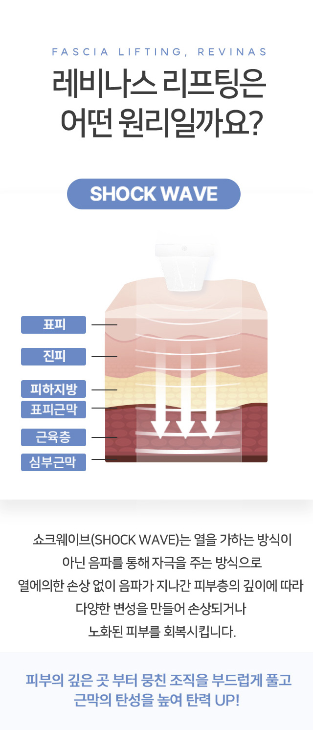 레비나스 리프팅(빠샤리프팅)