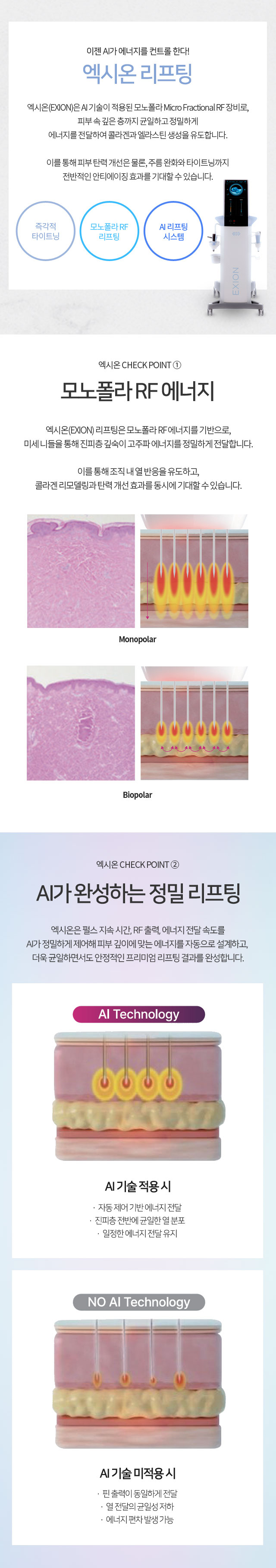 엑시온 리프팅